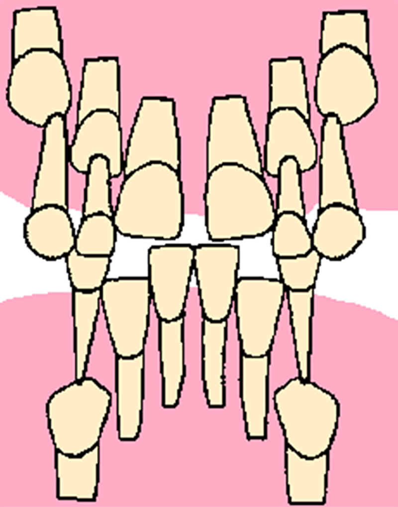 Dibujo esquemático de las características radiográficas observadas por Van der Linden con referencia al incisivo lateral temporal inferior de un paciente con patrón de erupción normal.