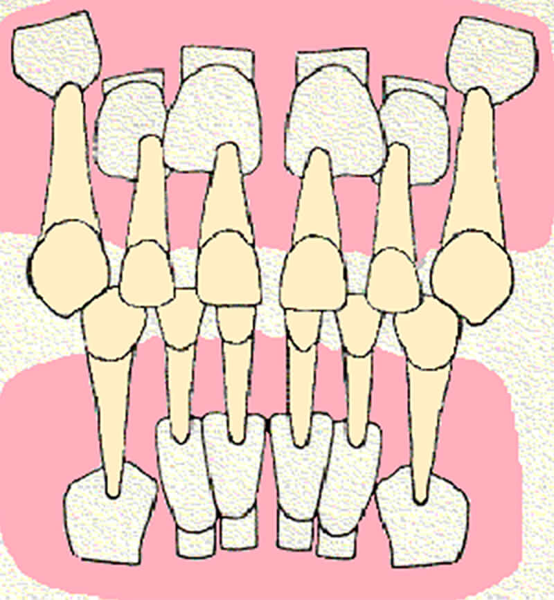 Dibujo esquemático de las características radiográficas observadas por Van der Linden en la zona anterosuperior de un paciente con patrón de erupción normal.