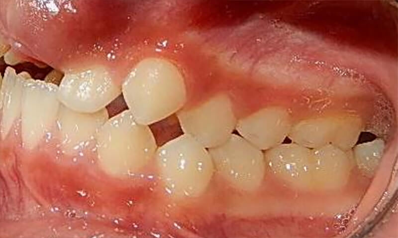 Fig. 4 Lateral izquierda