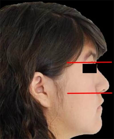 Fig. 2 Perfil