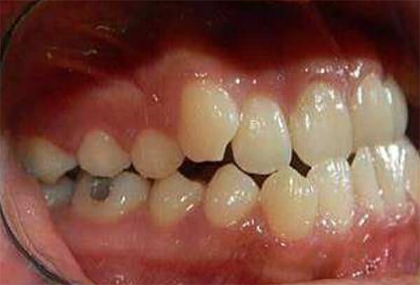 Fig. 3 Intraoral derecha