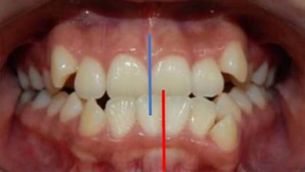 Fig. 5 Frente