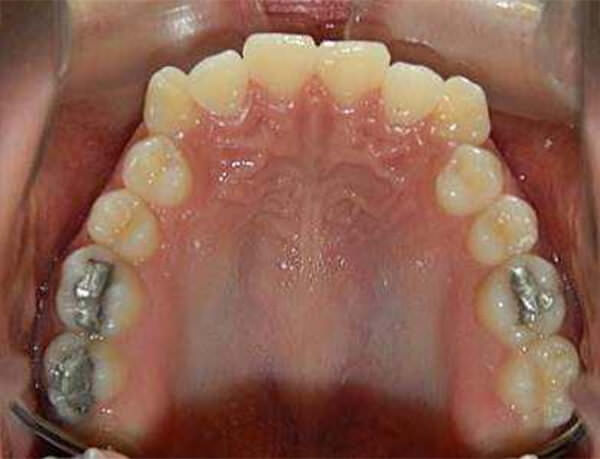 Fig. 6 Oclusal superior