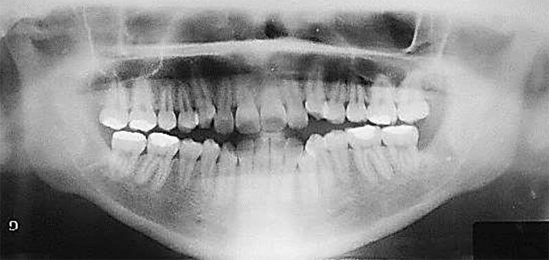 Fig. 8 Radiografía panorámica