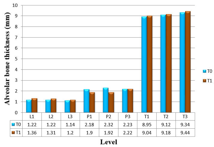 Graph 8: Alveolar bone thickness of upper left lateral incisor at T0 and T1 measurements