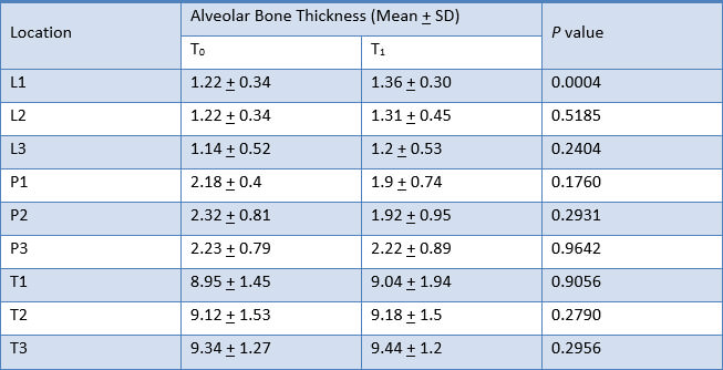 Table 8. Comparison of alveolar bone thickness of upper left lateral incisor at T0 and T1 measurements with Paired t-test