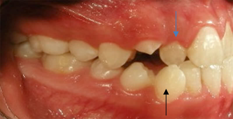 Fig. 4 Lateral derecha