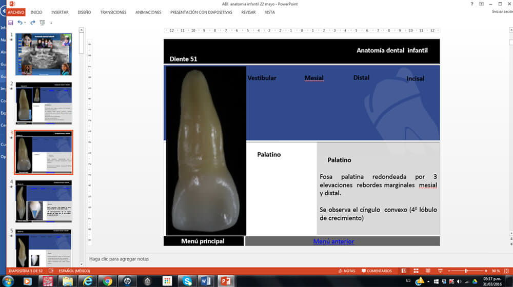 Fig. 1 Pantalla donde se muestra cada una de las superficies de la pieza dentaria, con la descripción característica de la pared.