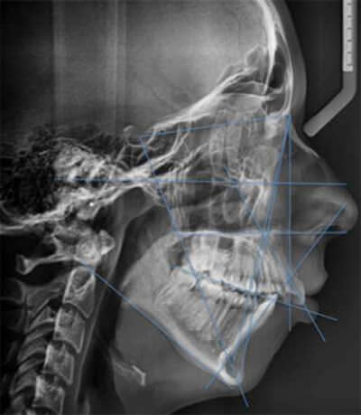 Fig. 1 Rx lateral de cráneo