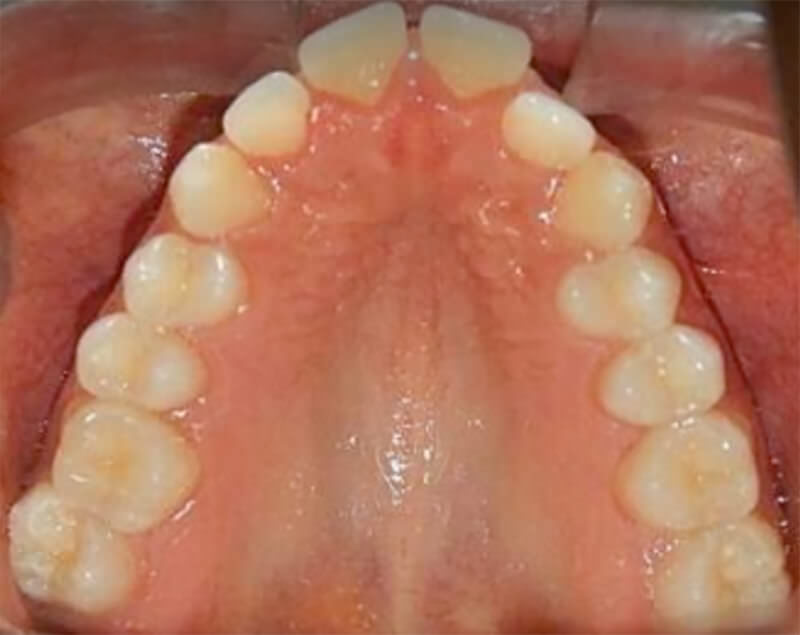 Fig. 7 Oclusal superior