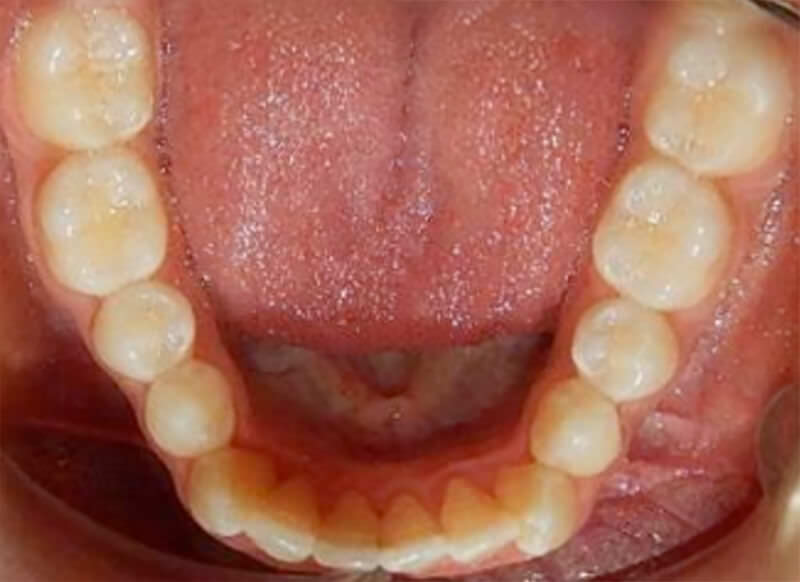 Fig. 8 Oclusal inferior