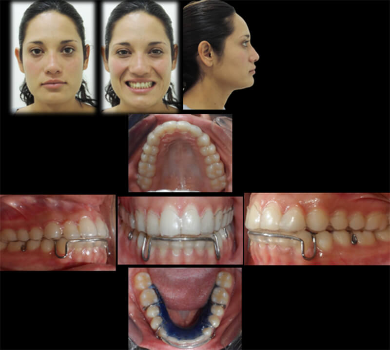 Figura 12. Estudios finales