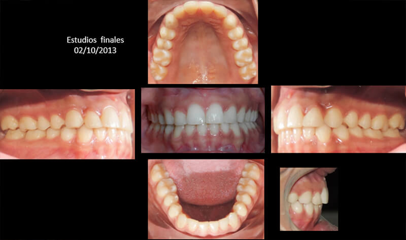 Figura 12. Estudios finales