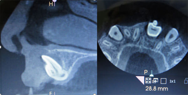 Figura 11: Imágenes de Cone beam