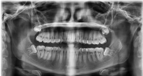 Figura 8 Radiografía panorámica al final del tratamiento