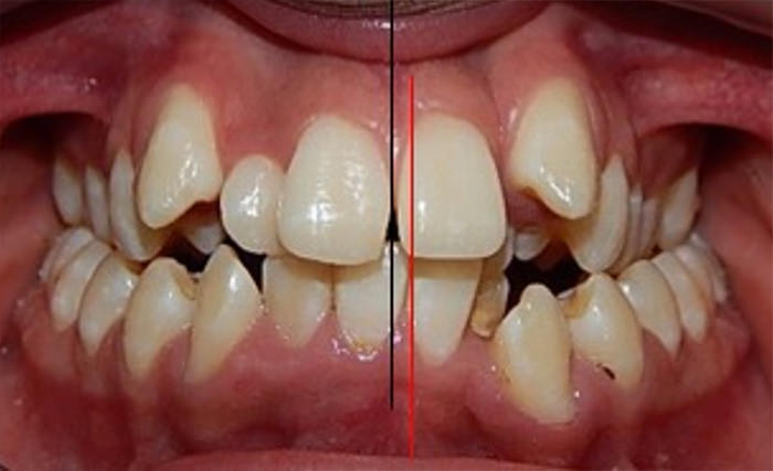 Fig. 5 Intraoral de frente