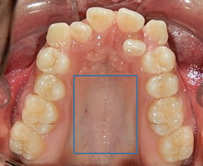 Fig. 6 Oclusal superior