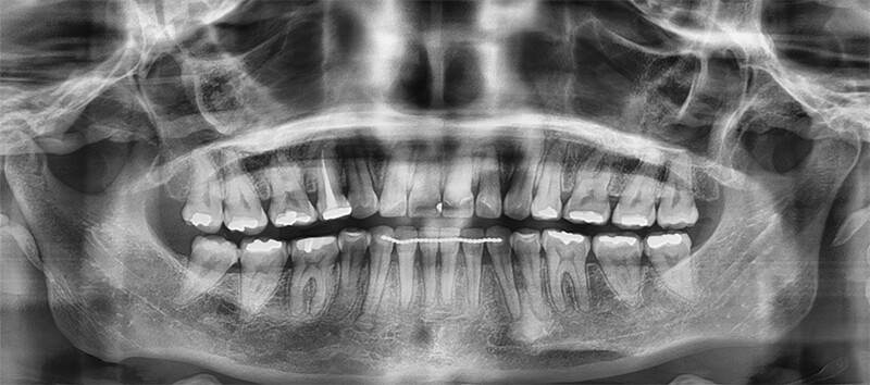 Figura 18. Radiografía panorámica