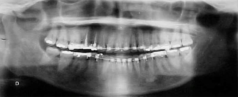 Figura 7. Radiografía panorámica