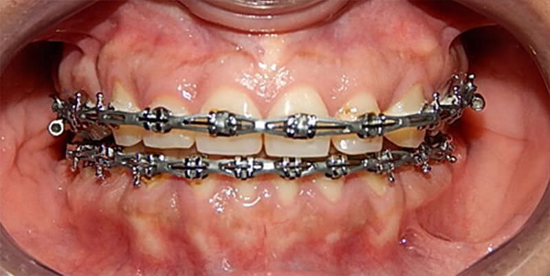 Figura 9. Intraoral de frente