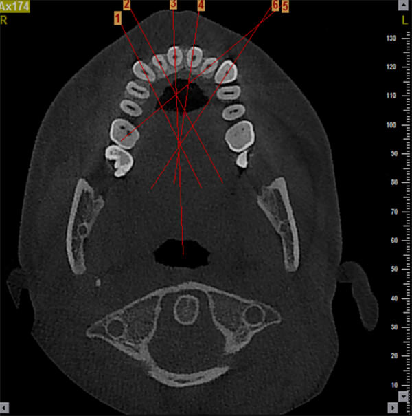 Imagen Axial