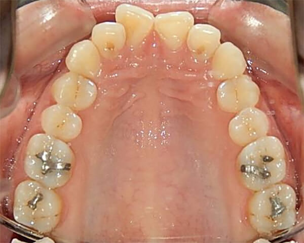 Fig. 9 Superior Oclusal