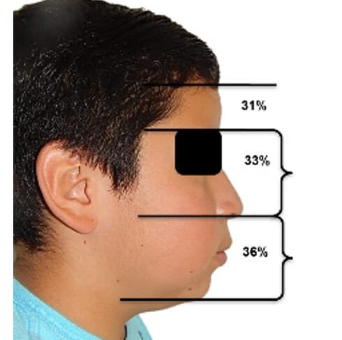 Fig. 2.  de perfil