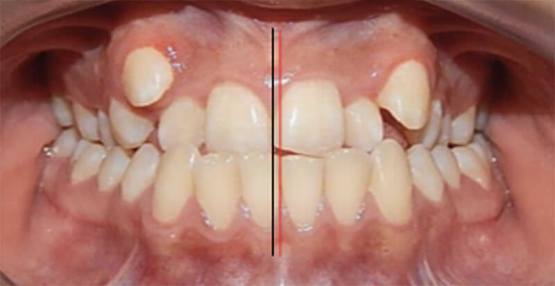 Fig. 3 Frente