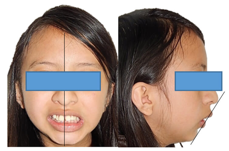 Fig.1  extraorales de frente y perfil