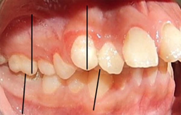 Fig. 4 Lateral derecha, de frente y lateral izquierda