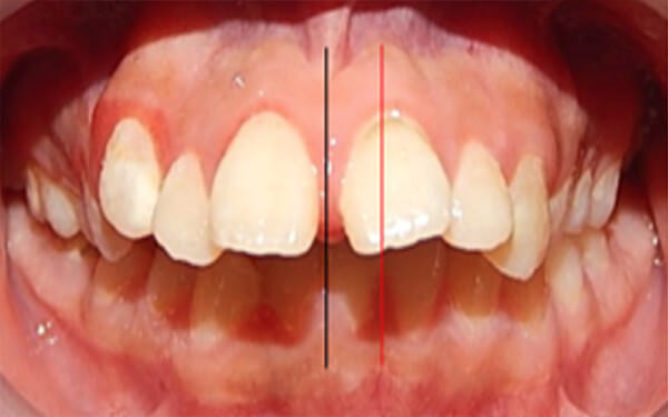 Fig. 4 Lateral derecha, de frente y lateral izquierda