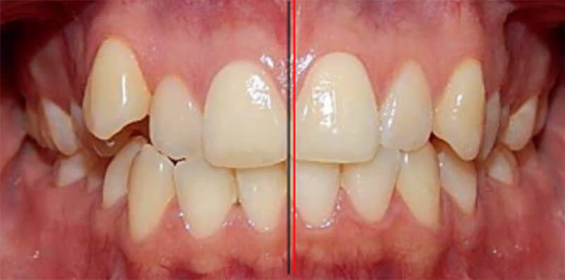 Fig. 3 Intraoral frente