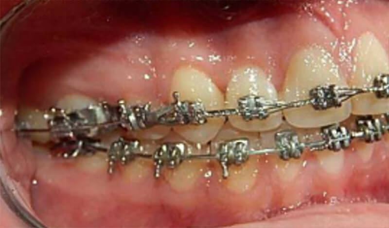 Fig. 8 Lateral derecha