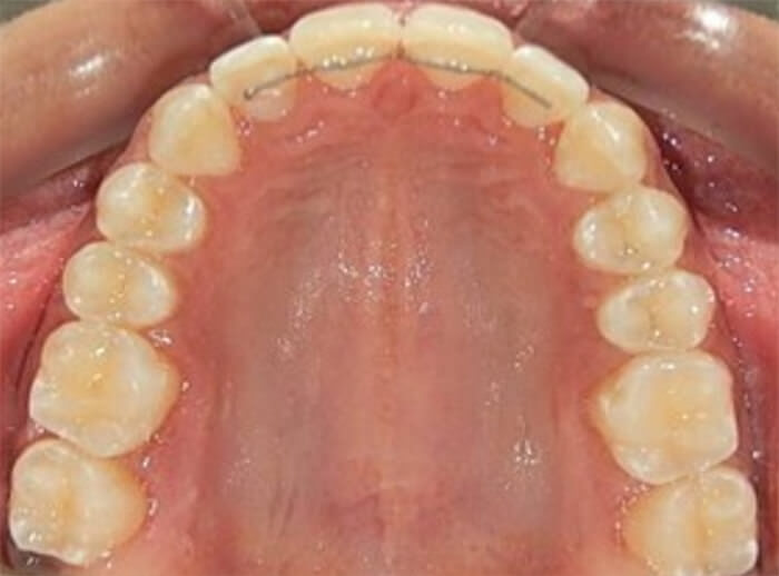 Fig. 16 vista oclusal superior inferior