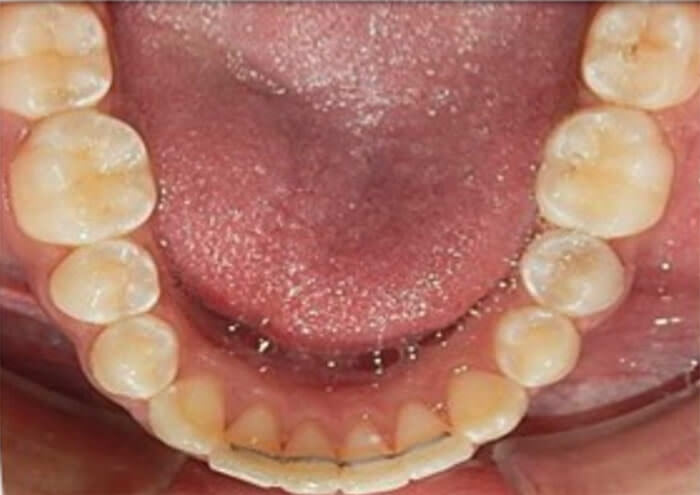 Fig. 16 vista oclusal superior inferior