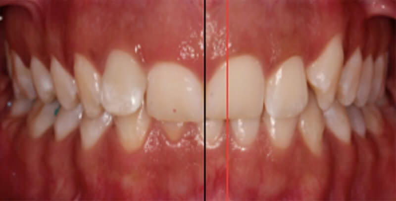 Fig. 5 Intraoral de frente