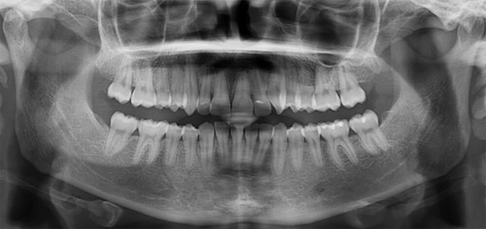 Fig. 7 radiografía panorámica