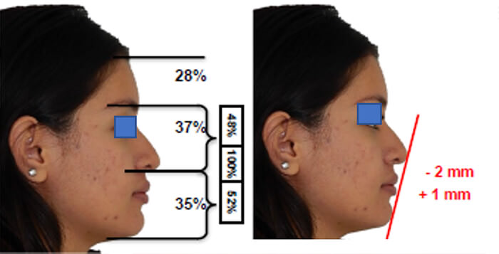 Fig. 19 comparativa inicio final