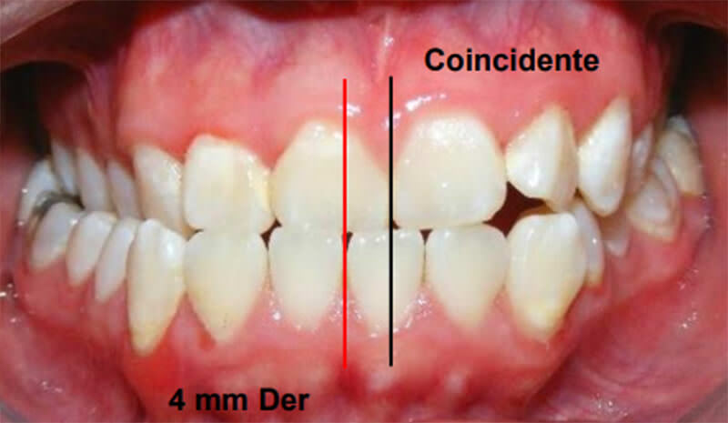 Fig. 3 Intraoral de frente