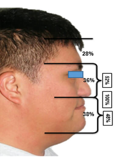 Fig. 2 Perfil