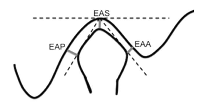 Esquema 1. Distancias entre el cóndilo de la mandíbula y la fosa mandibular del hueso temporal.