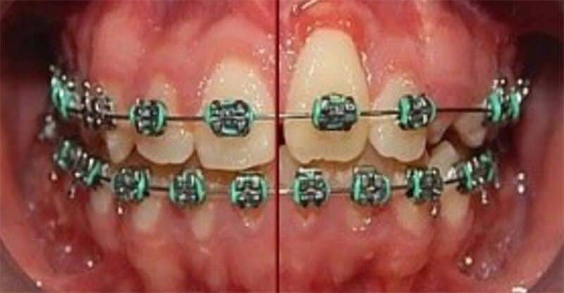 Fig. 10 intraoral de frente