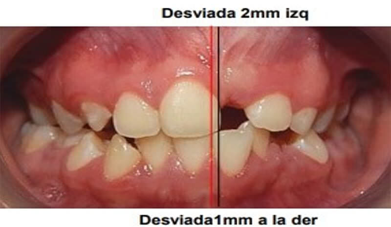 Fig. 5 Intraoral de frente