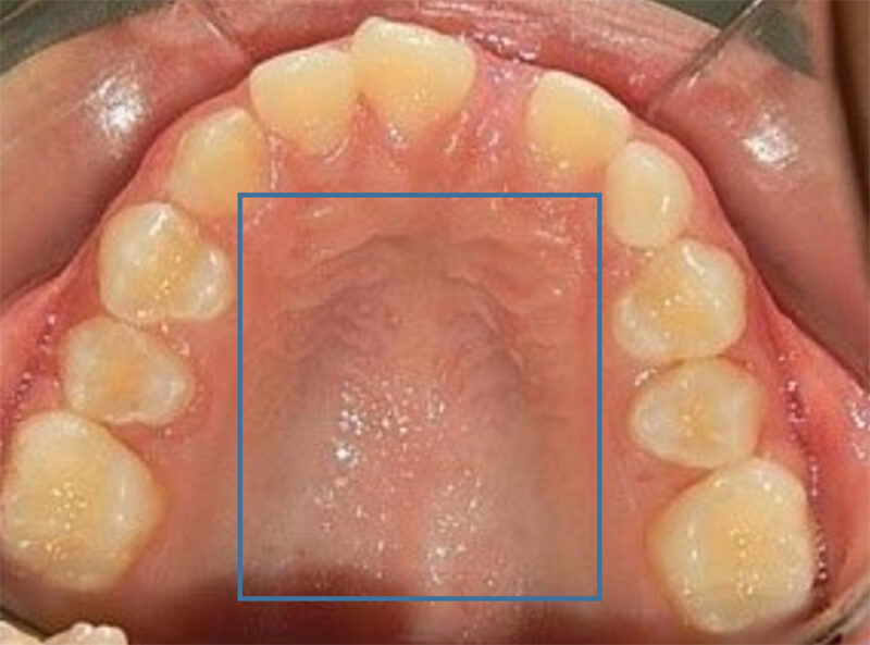 Fig. 6 oclusal superior