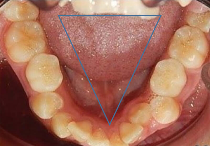 Fig. 7 oclusal inferior