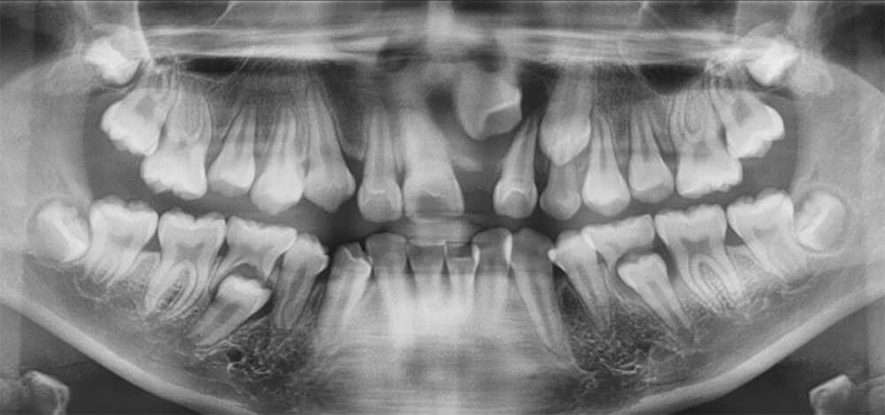 Fig. 8 radiografía panorámica