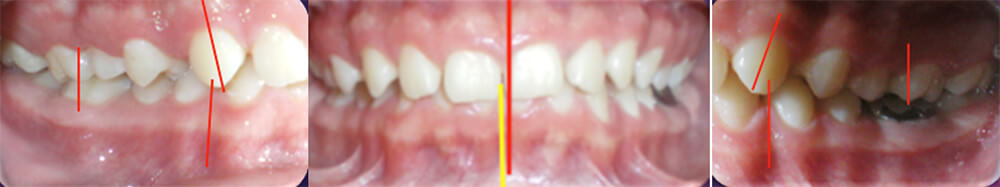 Fig 2. Analisis Extraoral