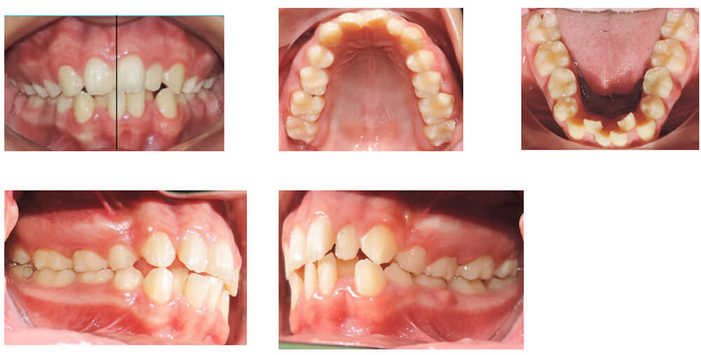 Fig.2 Análisis intraoral