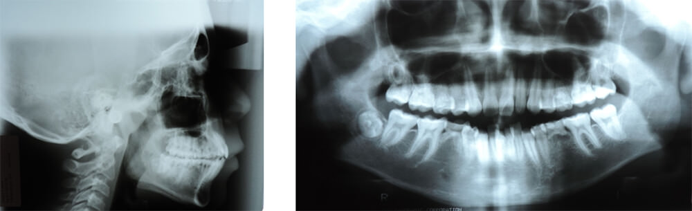 Fig. 3 Análisis radiográfico