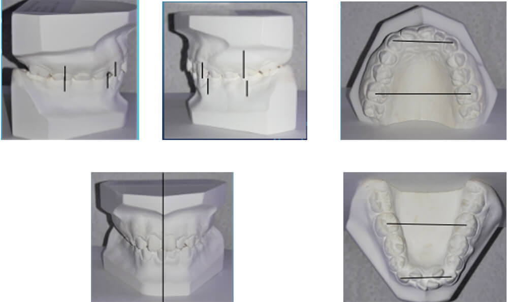 Fig. 4 análisis de modelos